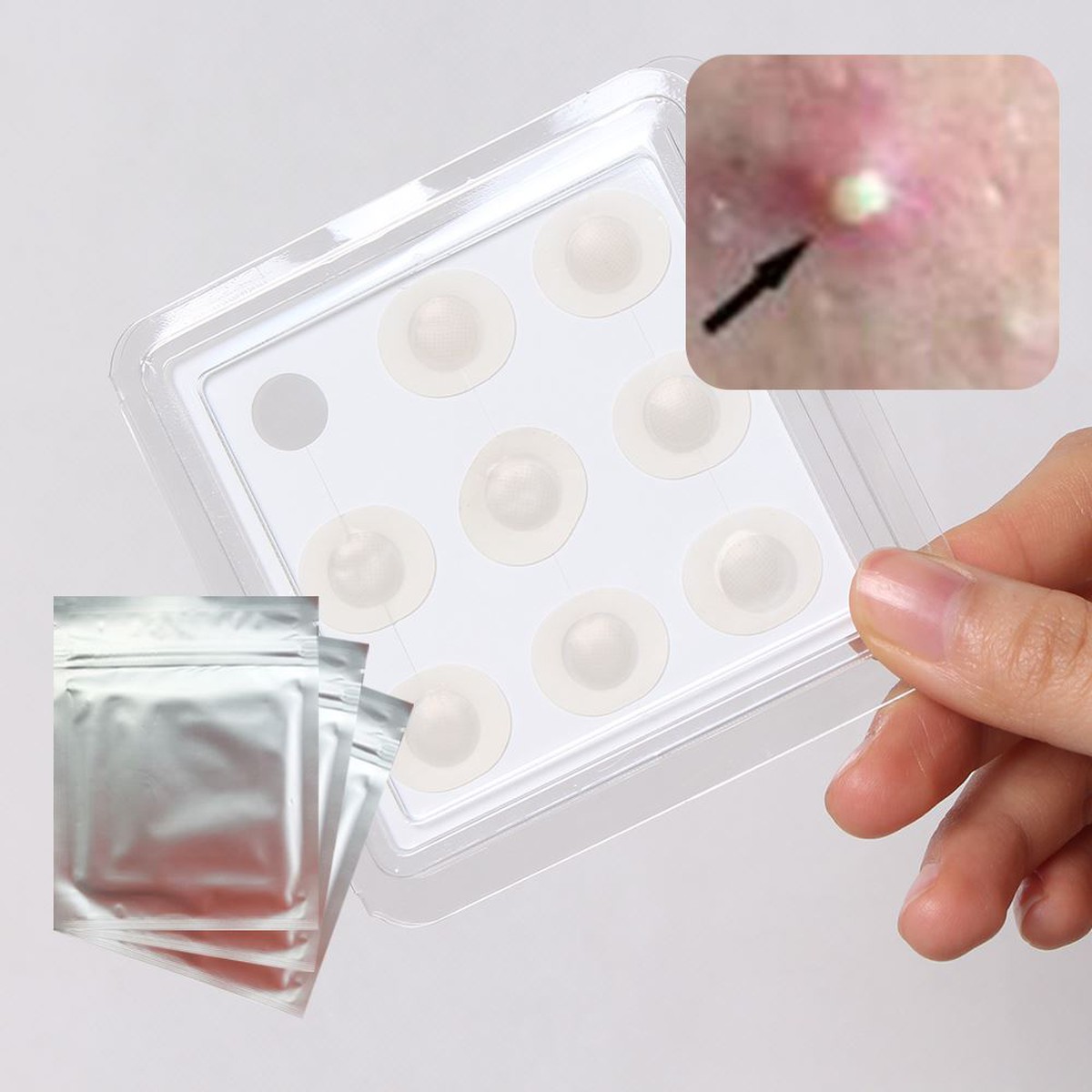 microneedle Acne patch microneedle Acne patch
